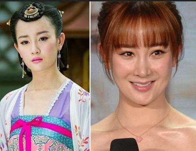 坦然面對(duì)整容，女明星的美麗新篇章之旅