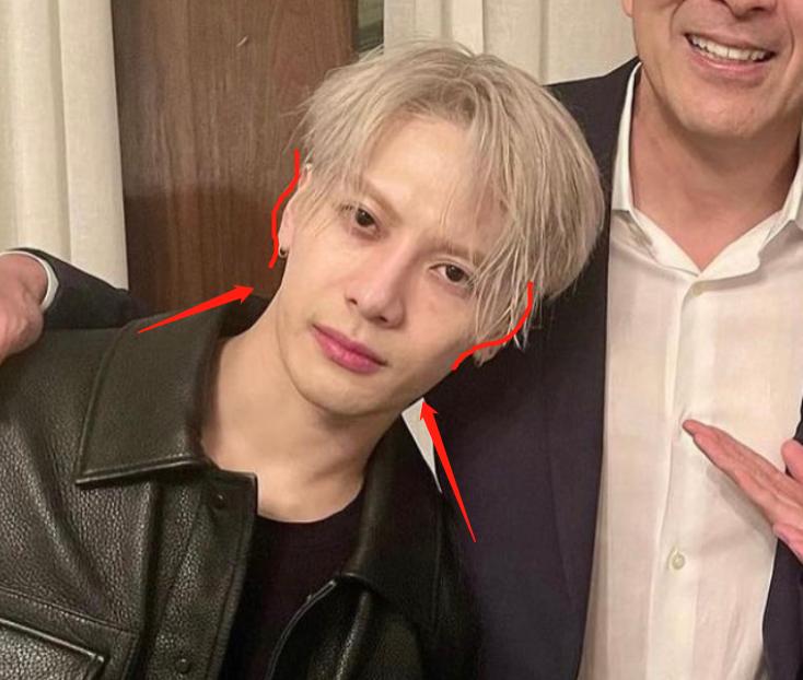 深度解析明星整容后遺癥，觀點(diǎn)與影響探討