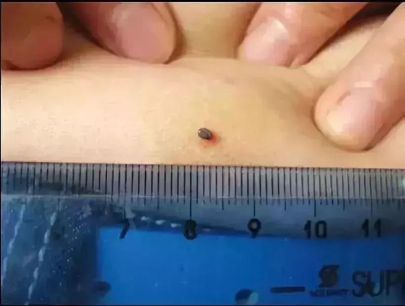 小明快樂疫情日志，最新疫情發(fā)布與日常觀察