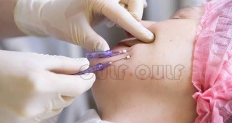 線(xiàn)雕最新手法，背景、發(fā)展、時(shí)代地位及展望